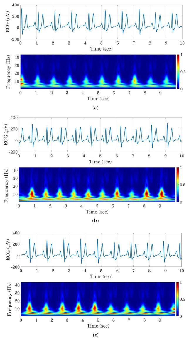 Three graphs showing how E C G signal frequency increases as the subject becomes drowsier. The frequency for alert drivers was .5 hz or less, while extremely drowsy drivers reached 1 hz.