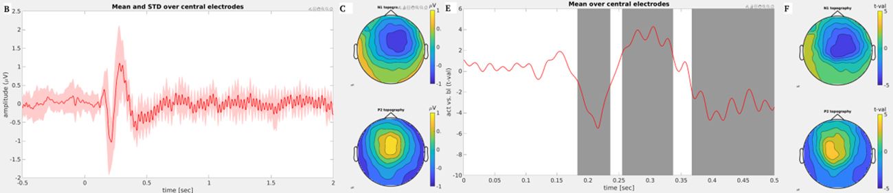 Side-by-side line graphs with topographies of the brain.