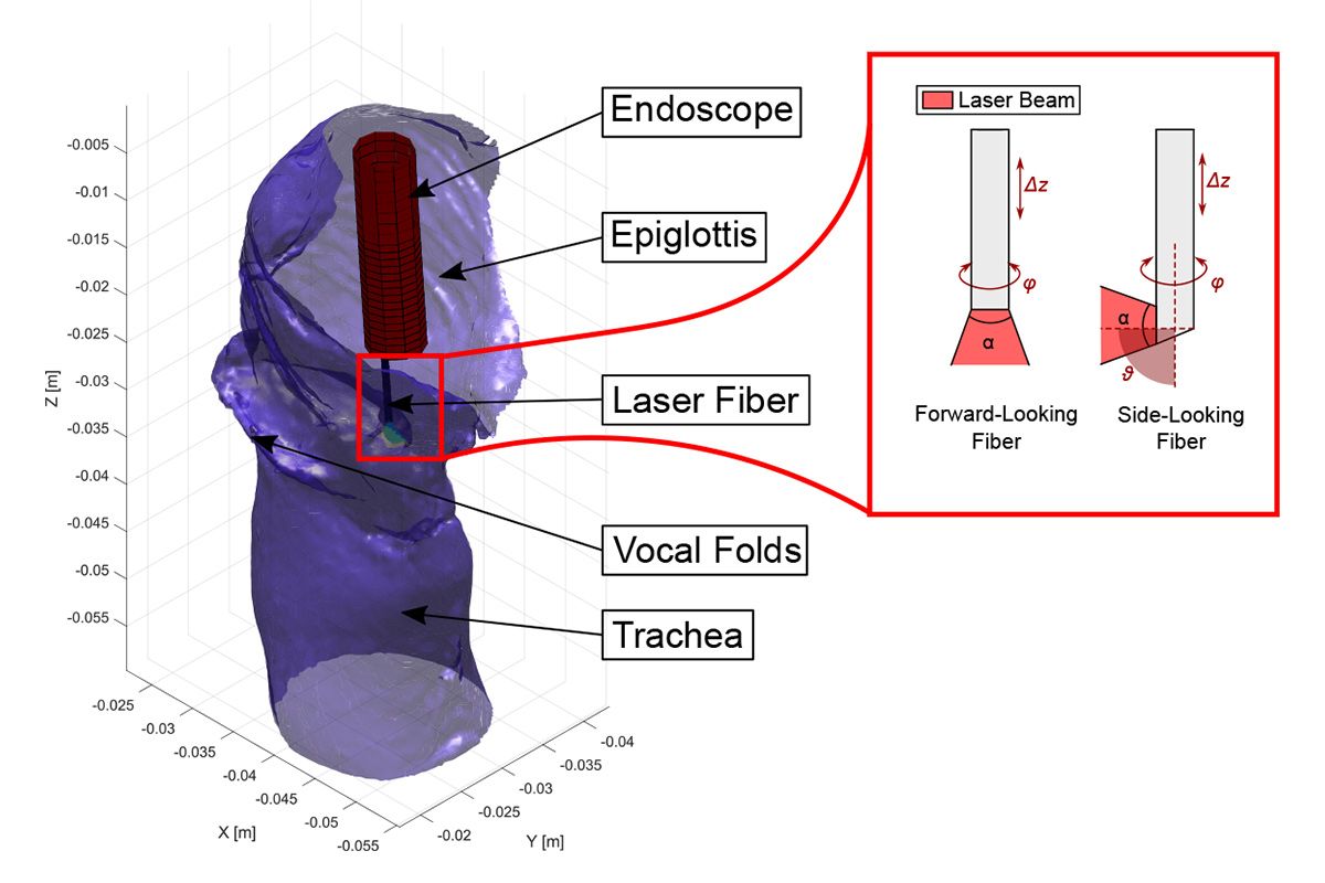 A larynx simulation showing the inserted endoscope, the epiglottis, vocal folds, and trachea. The laser model on the right shows the side-looking fiber has up to 90 degrees of movement compared to the forward-looking fiber.