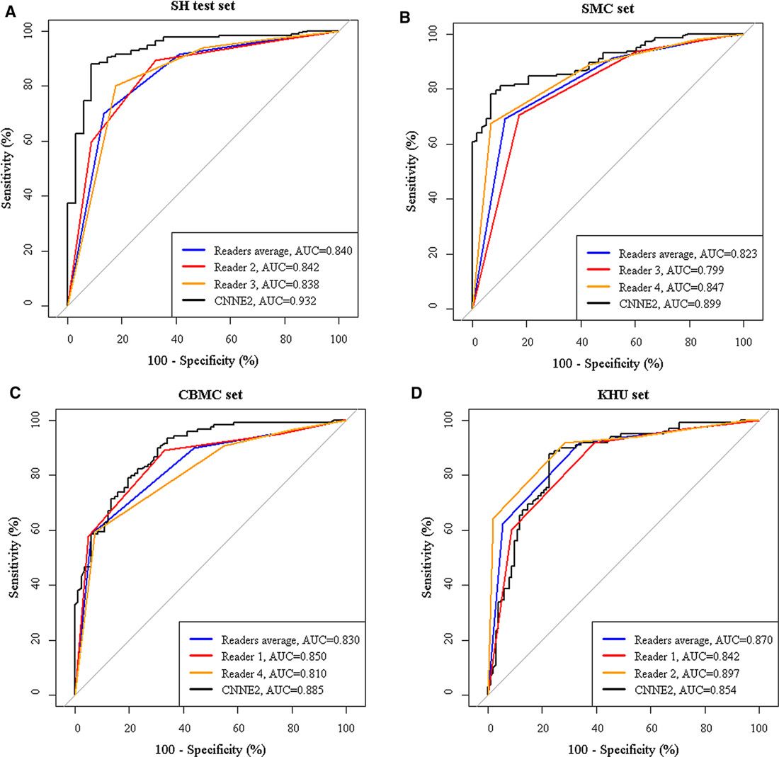 Four graphs with specificity on the x-axis and sensitivity on the y-axis. These graphs compare the R O C curves of the CNN ensemble and those of expert radiologists for differentiating thyroid nodules across four data sets.