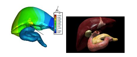 Figure 5. 3D renderings of a liver surface computed using PGD.
