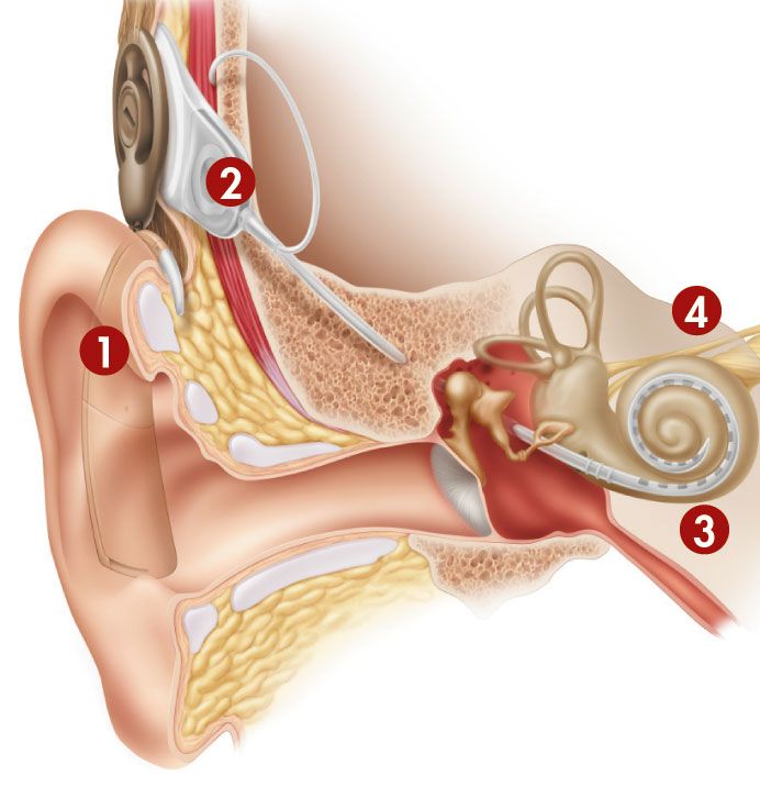 cochlear_fig3_w.gif