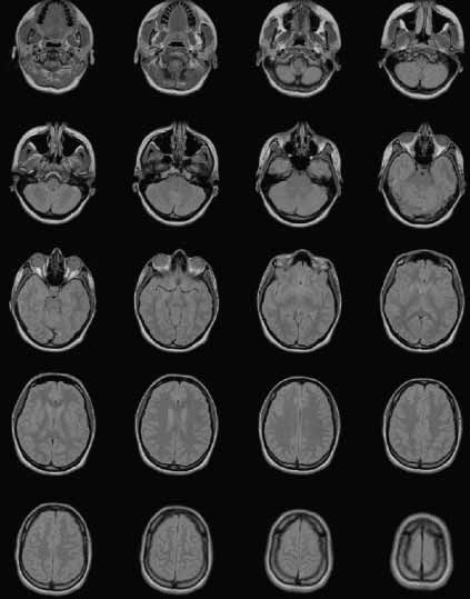 MR image saved in DICOM format.