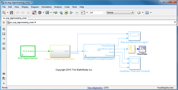 Real-Time ECG QRS Detection on ARM Cortex-M Processor