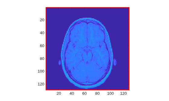 Figure contains an axes object. The axes object contains an object of type image.