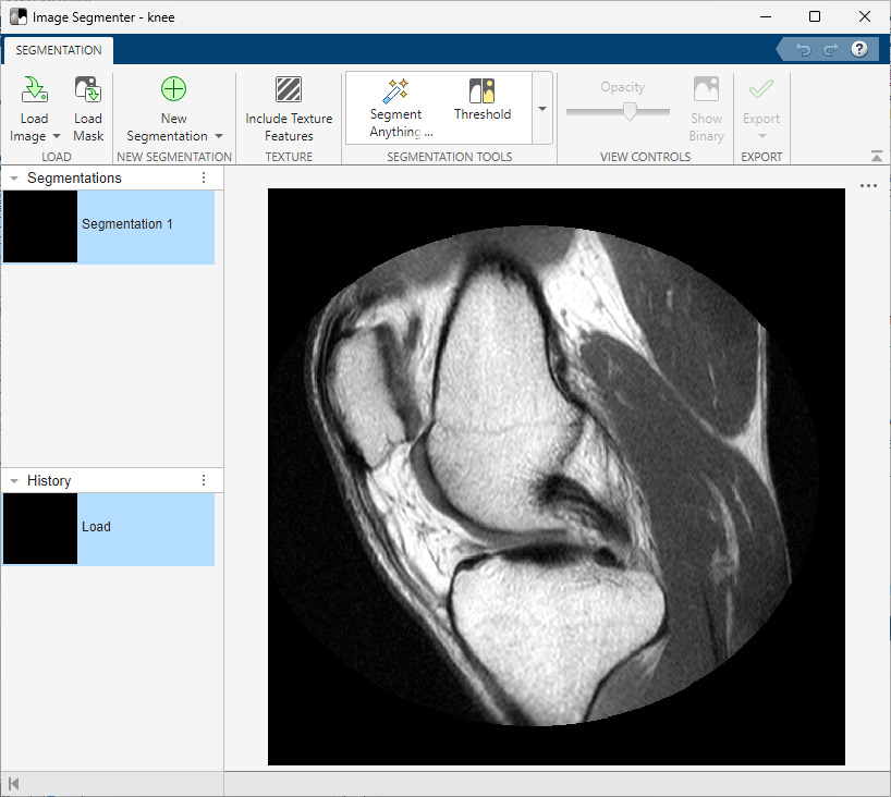 Image Segmenter app showing a scan of a human knee.