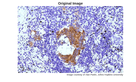 Figure contains an axes object. The hidden axes object with title Original Image contains 2 objects of type image, text.