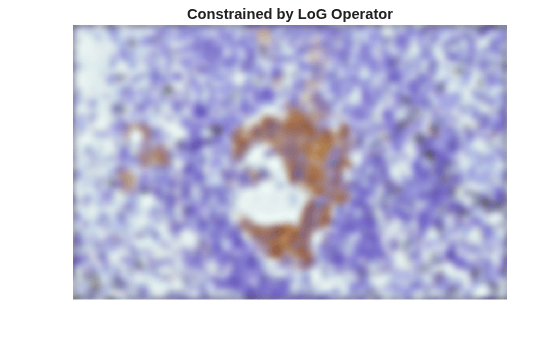 Figure contains an axes object. The hidden axes object with title Constrained by LoG Operator contains an object of type image.
