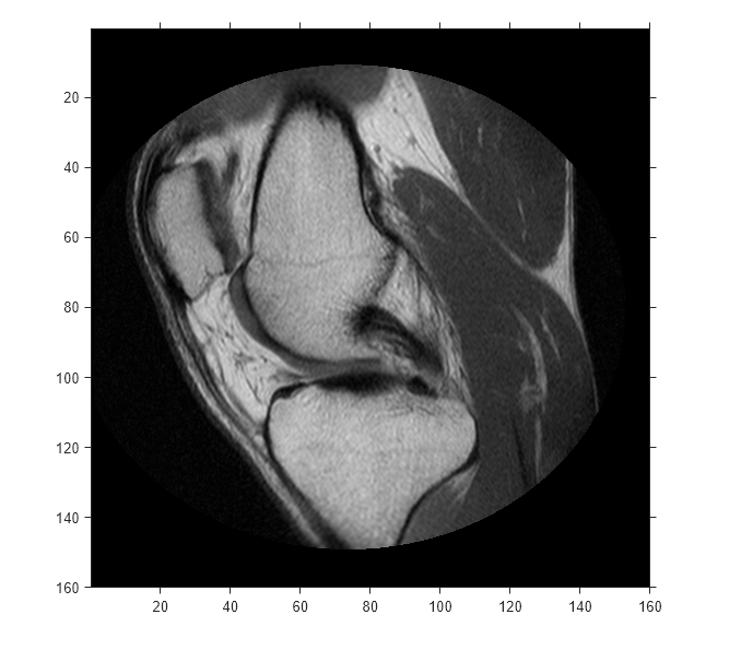 Figure contains an axes object. The axes object contains an object of type image.