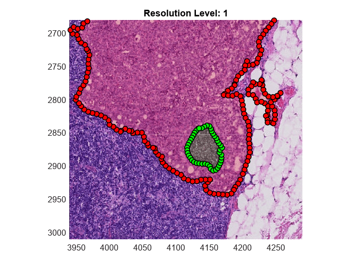 Figure contains an axes object. The axes object with title Resolution Level: 1 contains 8 objects of type bigimageshow, images.roi.polygon.