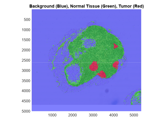 Figure contains an axes object. The axes object with title Background (Blue), Normal Tissue (Green), Tumor (Red) contains an object of type bigimageshow.