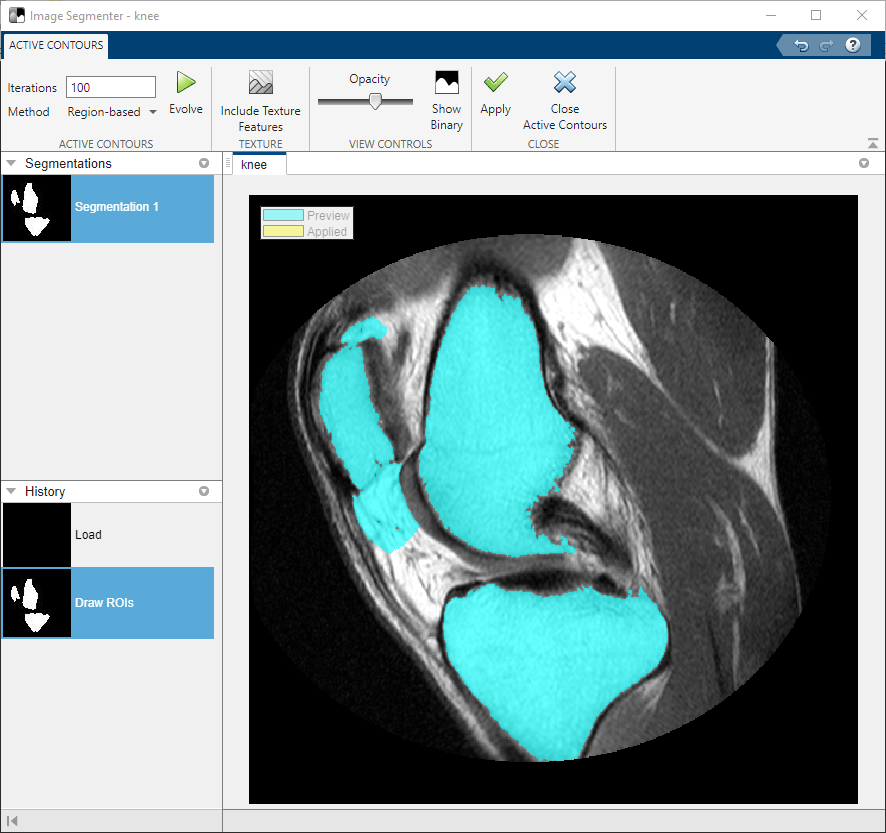 SegmentAnImageActiveContoursInImageSegExample_04.png