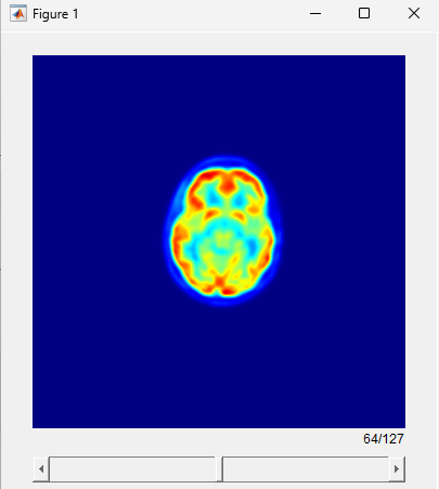 Slice viewer visualization of static PET volume.