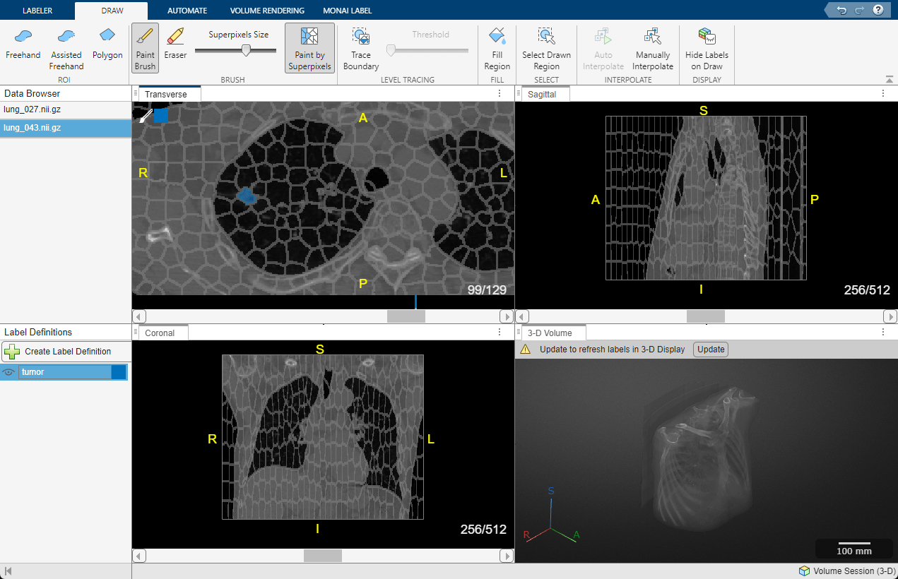 Label 3-D Medical Image Using Medical Image Labeler