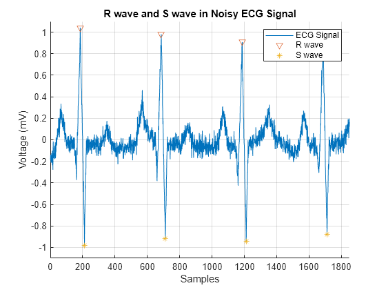 Figure contains an axes object. The axes object with title R wave and S wave in Noisy ECG Signal, xlabel Samples, ylabel Voltage (mV) contains 3 objects of type line. One or more of the lines displays its values using only markers These objects represent ECG Signal, R wave, S wave.