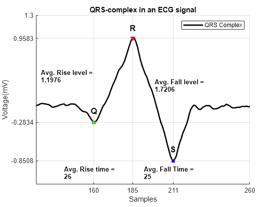 Figure contains an axes object. The axes object with title QRS-complex in an ECG signal, xlabel Samples, ylabel Voltage(mV) contains 11 objects of type line, text. One or more of the lines displays its values using only markers These objects represent QRS Complex, Peak, Minima.