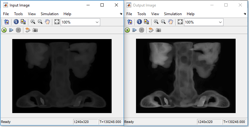 Contrast Limited Adaptive Histogram Equalization