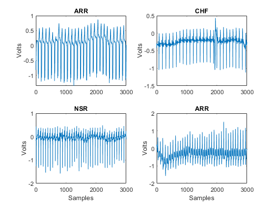 Signal Classification Using Wavelet-Based Features and Support Vector Machines