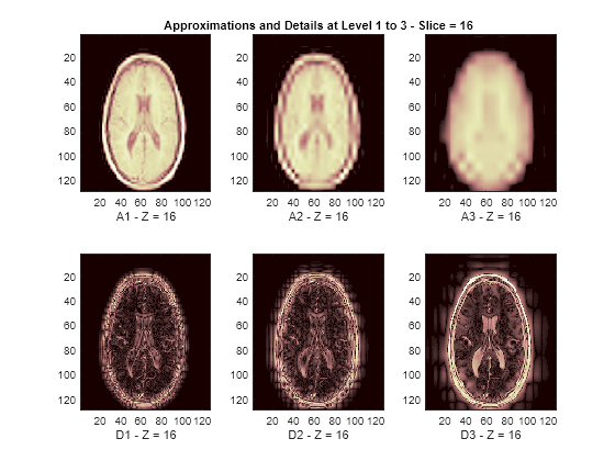 Figure contains 6 axes objects. Axes object 1 with xlabel A1 - Z = 16 contains an object of type image. Axes object 2 with xlabel D1 - Z = 16 contains an object of type image. Axes object 3 with title Approximations and Details at Level 1 to 3 - Slice = 16, xlabel A2 - Z = 16 contains an object of type image. Axes object 4 with xlabel D2 - Z = 16 contains an object of type image. Axes object 5 with xlabel A3 - Z = 16 contains an object of type image. Axes object 6 with xlabel D3 - Z = 16 contains an object of type image.