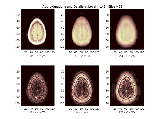 Figure contains 6 axes objects. Axes object 1 with xlabel A1 - Z = 25 contains an object of type image. Axes object 2 with xlabel D1 - Z = 25 contains an object of type image. Axes object 3 with title Approximations and Details at Level 1 to 3 - Slice = 25, xlabel A2 - Z = 25 contains an object of type image. Axes object 4 with xlabel D2 - Z = 25 contains an object of type image. Axes object 5 with xlabel A3 - Z = 25 contains an object of type image. Axes object 6 with xlabel D3 - Z = 25 contains an object of type image.