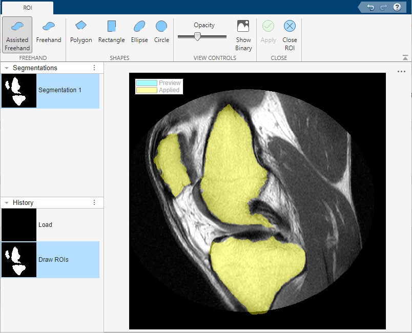 Overlay that indicates which regions are selected for segmentation.