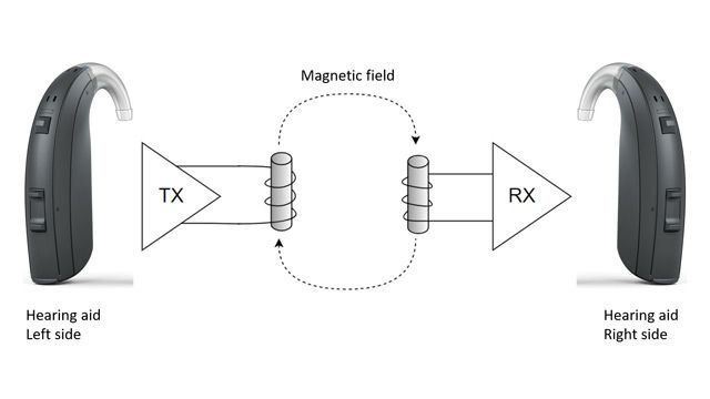 GN Hearing Accelerates Development of Next-Generation Hearing Aid ASICs