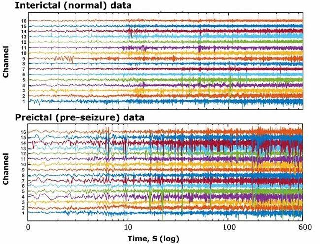 Using Machine Learning to Predict Epileptic Seizures from EEG Data